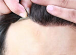 Complément capillaire homme, base dentelle et fine peau autour. Cheveux 100% naturels-2
